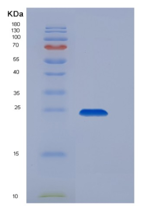 Recombinant Rat Layilin / LAYN Protein (His tag),Recombinant Rat Layilin / LAYN Protein (His tag)