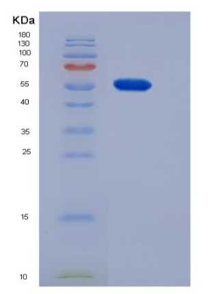 Recombinant Mouse CNDP1 Protein (His tag),Recombinant Mouse CNDP1 Protein (His tag)