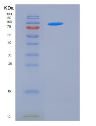 Recombinant Human STXBP3 / UNC-18C Protein (His & GST tag),Recombinant Human STXBP3 / UNC-18C Protein (His & GST tag)