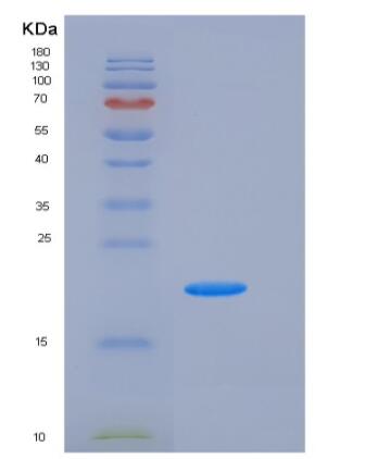 Recombinant Human H1F0 / Histone H1 Protein (His tag),Recombinant Human H1F0 / Histone H1 Protein (His tag)