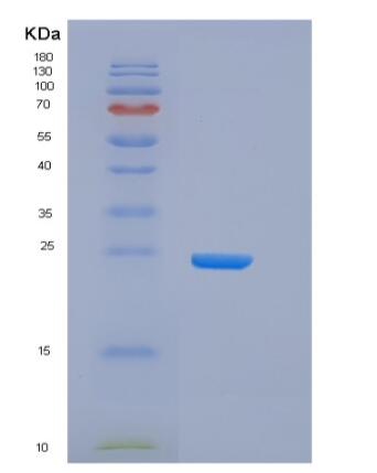 Recombinant Human CD32B Protein (His &AVI Tag), Biotinylated,Recombinant Human CD32B Protein (His &AVI Tag), Biotinylated