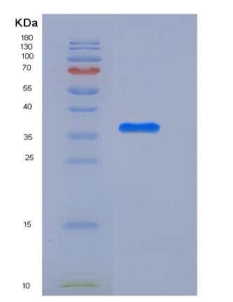 Recombinant Human APEX1 / AP / APEx / Ref-1 Protein (His tag),Recombinant Human APEX1 / AP / APEx / Ref-1 Protein (His tag)