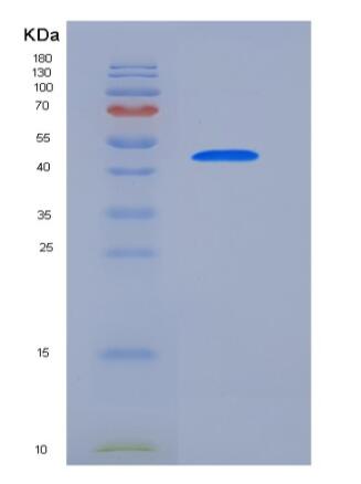 Recombinant Human CCNE1 / Cyclin-E1 Protein,Recombinant Human CCNE1 / Cyclin-E1 Protein