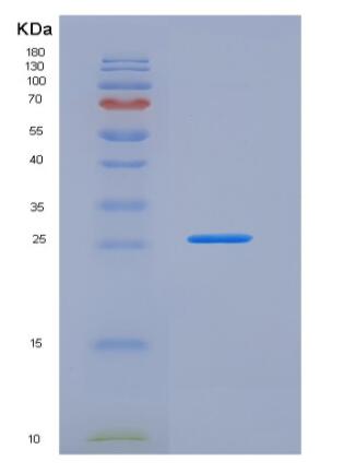 Recombinant Mouse FLRG / Fstl3 Protein (His tag),Recombinant Mouse FLRG / Fstl3 Protein (His tag)