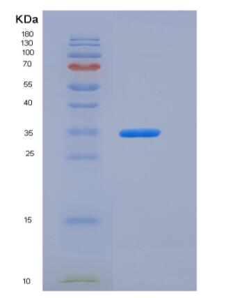 Recombinant Human Carbonic Anhydrase VB / CA5B Protein (His tag),Recombinant Human Carbonic Anhydrase VB / CA5B Protein (His tag)