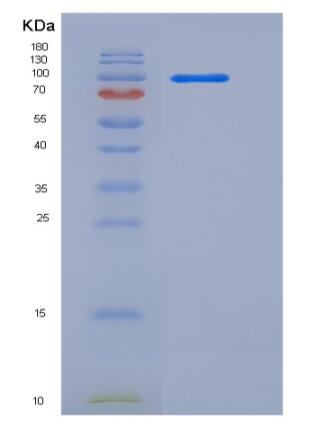 Recombinant Human Contactin 4 / CNTN4 Protein (His tag),Recombinant Human Contactin 4 / CNTN4 Protein (His tag)