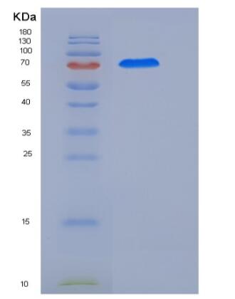 Recombinant Human CCNE1 / Cyclin-E1 Protein (His & GST tag),Recombinant Human CCNE1 / Cyclin-E1 Protein (His & GST tag)