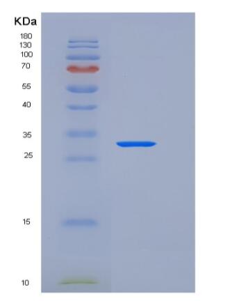 Recombinant Mouse sFRP2 Protein (His tag),Recombinant Mouse sFRP2 Protein (His tag)