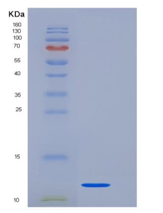 Recombinant Rat TGF beta 1 Protein,Recombinant Rat TGF beta 1 Protein