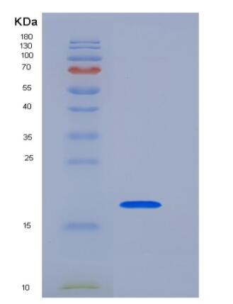 Recombinant Human CD153 / CD30L / TNFSF8 Protein,Recombinant Human CD153 / CD30L / TNFSF8 Protein