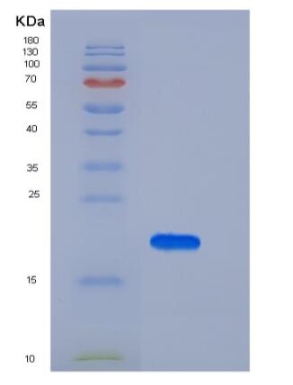 Recombinant Human IL10 / Interleukin-10 Protein,Recombinant Human IL10 / Interleukin-10 Protein