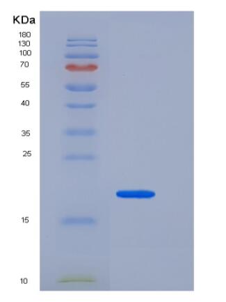 Recombinant Human / Cynomolgus VEGF / VEGFA / VEGF165 Protein,Recombinant Human / Cynomolgus VEGF / VEGFA / VEGF165 Protein