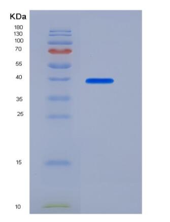 Recombinant Human / Mouse / Rat / Rhesus / Canine BMP-2 Protein (Fc Tag),Recombinant Human / Mouse / Rat / Rhesus / Canine BMP-2 Protein (Fc Tag)