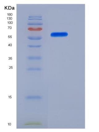 Recombinant Human IL-12 (IL12A &IL12B Heterodimer) Protein (His Tag),Recombinant Human IL-12 (IL12A &IL12B Heterodimer) Protein (His Tag)