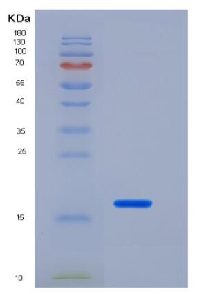 Recombinant Mouse IL-1 beta / IL1B Protein,Recombinant Mouse IL-1 beta / IL1B Protein