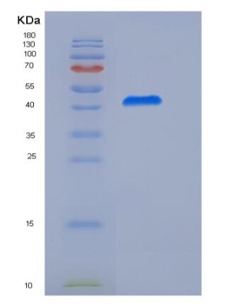 Recombinant Human Vaspin / SerpinA12 Protein (His tag),Recombinant Human Vaspin / SerpinA12 Protein (His tag)