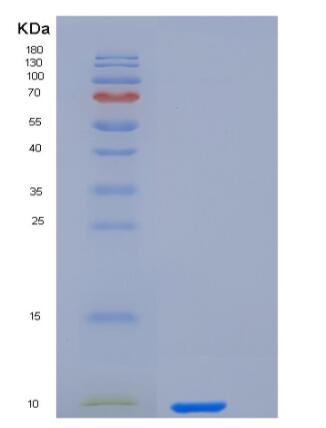 Recombinant Human IL-8 / CXCL8 Protein (aa 28-99),Recombinant Human IL-8 / CXCL8 Protein (aa 28-99)