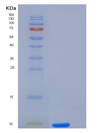 Recombinant Human IL-8 / CXCL8 Protein (aa 23-99),Recombinant Human IL-8 / CXCL8 Protein (aa 23-99)