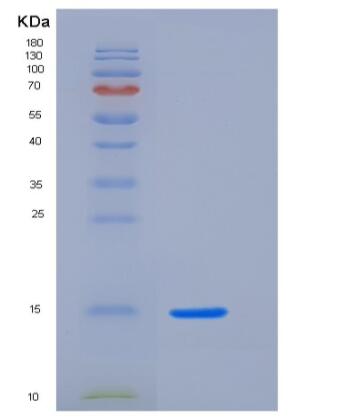 Recombinant Human BST2 Protein (His Tag),Recombinant Human BST2 Protein (His Tag)
