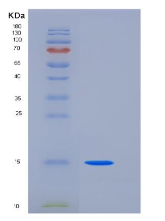 Recombinant Human CD82 / KAI-1 Protein (His tag),Recombinant Human CD82 / KAI-1 Protein (His tag)