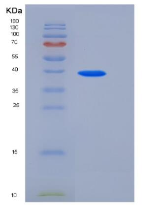 Recombinant Human TETHERIN / BST2 / CD317 Protein (Fc tag),Recombinant Human TETHERIN / BST2 / CD317 Protein (Fc tag)