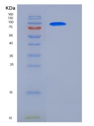 Recombinant Human GAD65 / GAD2 / GAD-2 Protein (GST Tag),Recombinant Human GAD65 / GAD2 / GAD-2 Protein (GST Tag)