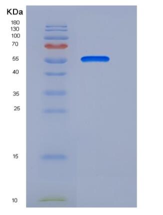 Recombinant Human TEM8 Protein (Fc Tag),Recombinant Human TEM8 Protein (Fc Tag)