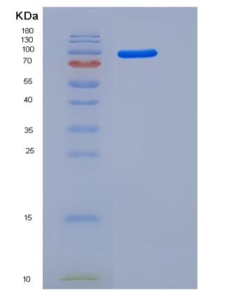 Recombinant Mouse AGO2 / Argonaute 2 / EIF2C2 Protein (His tag),Recombinant Mouse AGO2 / Argonaute 2 / EIF2C2 Protein (His tag)