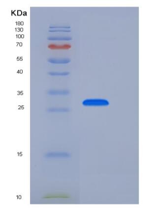 Recombinant Human CD33 / Siglec-3 Protein (His tag),Recombinant Human CD33 / Siglec-3 Protein (His tag)