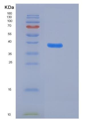 Recombinant Human ADM / Adrenomedullin Protein (Fc tag),Recombinant Human ADM / Adrenomedullin Protein (Fc tag)