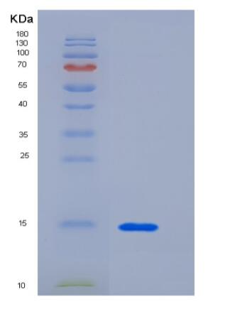 Recombinant Human CEACAM3 / CD66d Protein (His tag),Recombinant Human CEACAM3 / CD66d Protein (His tag)