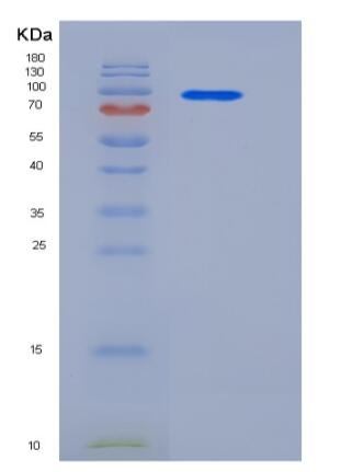 Recombinant Human Neuropilin-1 / NRP1 Protein (Fc tag),Recombinant Human Neuropilin-1 / NRP1 Protein (Fc tag)