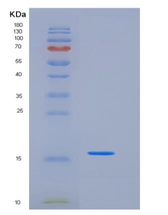 Recombinant Mouse FABP4 / ALBP / A-FABP Protein (His & MYC Tag),Recombinant Mouse FABP4 / ALBP / A-FABP Protein (His & MYC Tag)