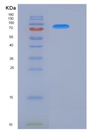 Recombinant Human ATF2 Protein (His & GST tag),Recombinant Human ATF2 Protein (His & GST tag)