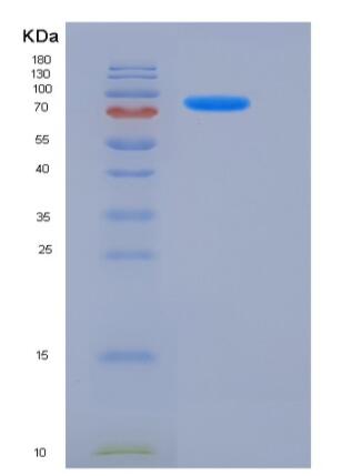 Recombinant Human PDE1B Protein (His & GST tag),Recombinant Human PDE1B Protein (His & GST tag)