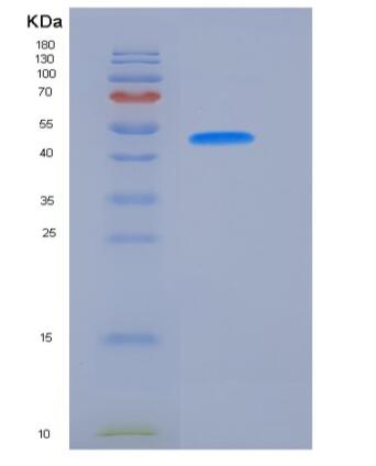 Recombinant Human VNN2 Protein (His Tag),Recombinant Human VNN2 Protein (His Tag)