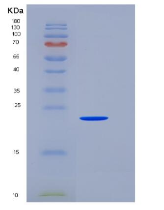 Recombinant Human SNAP25 / SUP Protein (His tag),Recombinant Human SNAP25 / SUP Protein (His tag)