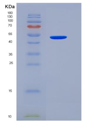 Recombinant Human VNN1 / Vanin-1 Protein (His tag),Recombinant Human VNN1 / Vanin-1 Protein (His tag)