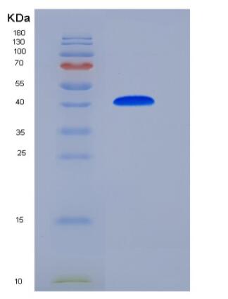 Recombinant Human NBL1 / DAND1 / DAN Protein (Fc tag),Recombinant Human NBL1 / DAND1 / DAN Protein (Fc tag)