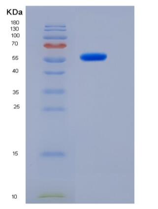 Recombinant Human ALDH1A3 / RALDH3 Protein (His tag),Recombinant Human ALDH1A3 / RALDH3 Protein (His tag)