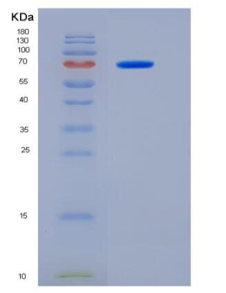 Recombinant Human MTSS1 Protein (aa1-250, His & MBP tag),Recombinant Human MTSS1 Protein (aa1-250, His & MBP tag)