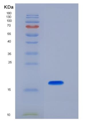 Recombinant Mouse Peroxiredoxin 5 / PRDX5 Protein (His tag),Recombinant Mouse Peroxiredoxin 5 / PRDX5 Protein (His tag)