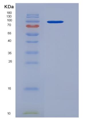 Recombinant Human AGO3 / Argonaute 3 / EIF2C3 Protein (His tag),Recombinant Human AGO3 / Argonaute 3 / EIF2C3 Protein (His tag)