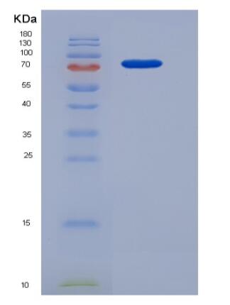 Recombinant Human HDAC3 / Histone deacetylase 3 Protein (His & GST tag),Recombinant Human HDAC3 / Histone deacetylase 3 Protein (His & GST tag)