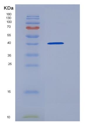 Recombinant Mouse BAMBI / NMA Protein (Fc tag),Recombinant Mouse BAMBI / NMA Protein (Fc tag)