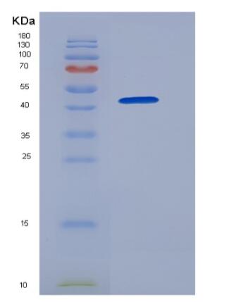 Recombinant Human GOLM1 / GP73 Protein (His tag),Recombinant Human GOLM1 / GP73 Protein (His tag)