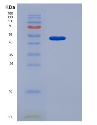 Recombinant Human CD122 / IL-2RB Protein (Fc tag),Recombinant Human CD122 / IL-2RB Protein (Fc tag)