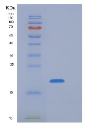 Recombinant Mouse NKG2A / NKG2 / CD159A / KLRC1 Protein (His tag),Recombinant Mouse NKG2A / NKG2 / CD159A / KLRC1 Protein (His tag)