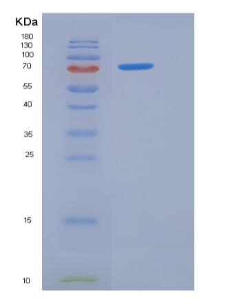 Recombinant Rat PCSK9 / NARC1 Protein (His tag),Recombinant Rat PCSK9 / NARC1 Protein (His tag)