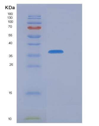 Recombinant Human CFHR1 Protein (His Tag),Recombinant Human CFHR1 Protein (His Tag)